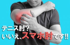 【上腕骨外側上顆炎とは？】スマホの操作を日常的に続けることで起きる肘の痛み